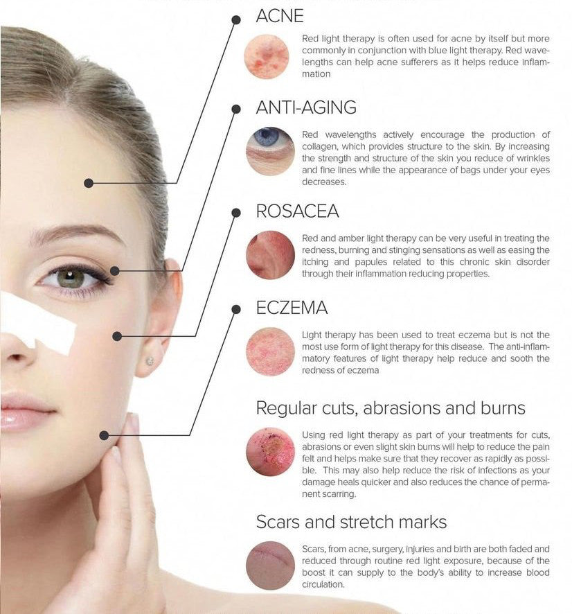 Diagram of red light therapy benefits on a woman's face with text explaining its uses.
